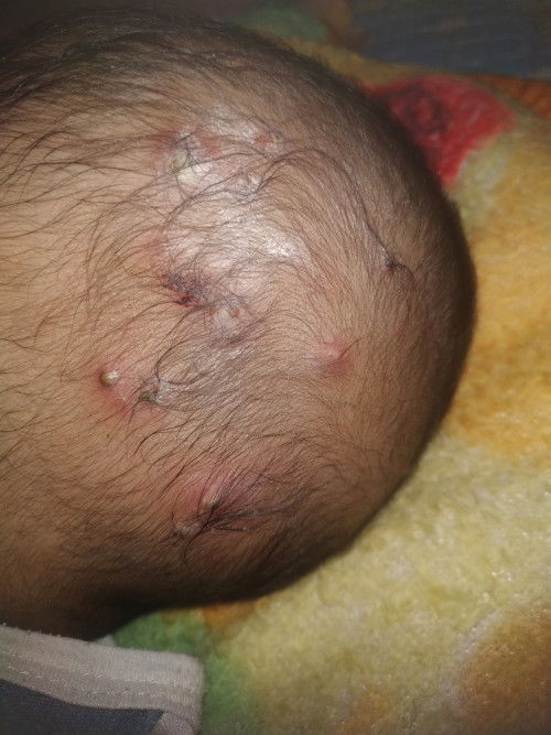 ada yang ngalami anaknya sakit ky gini bun kira* di kasih obat apa ya biar cepet sembuhnya