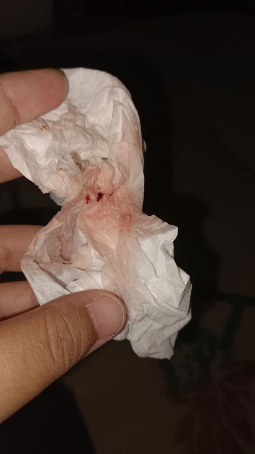 Hpl 9nov, Ini apa ya bund apa ini tanda mau melahirkan? Udah mulai kerasa mules si tapi masih ilang²