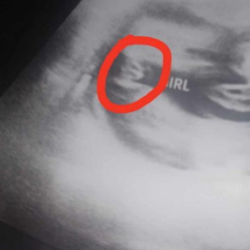 boy or girl?
