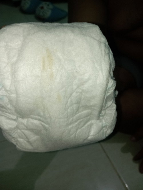 Keutihan pada bayi 8 bulan