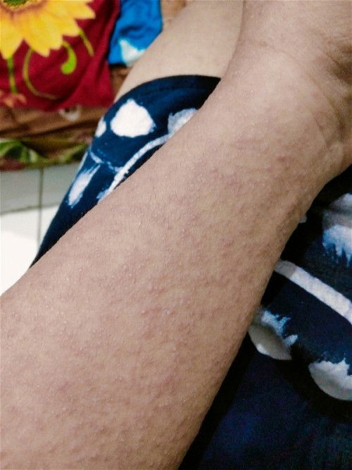 Biang keringat atau apa 😭