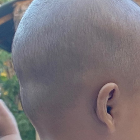 หัวลูก 5 เดือน