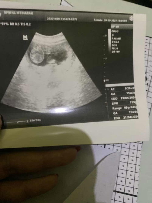 Hasil ug 2d usia janin 15W