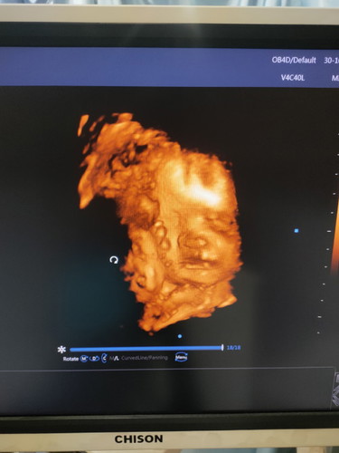 แม่ๆรบกวนช่วยดูหน่อยค่ะ กังวลใจมากๆเลยค่ะ