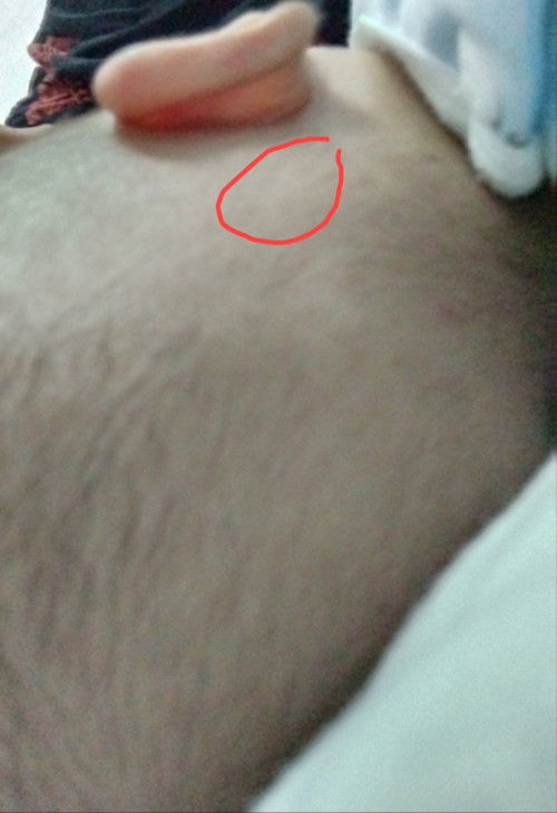 Benjolan dibelakang telinga bayi