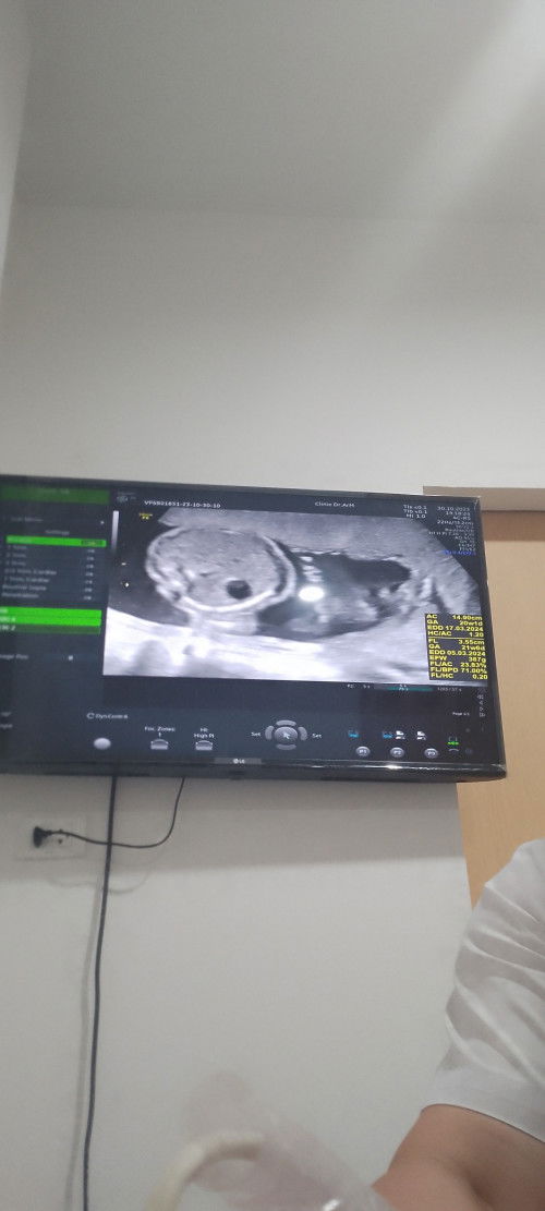 เพศของลูกแม่ๆแต่ละบ้าน