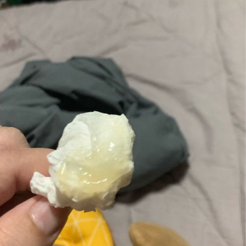 40w มีเมือกแบบนี้อีกนานไหมค่ะกว่าจะคลอด