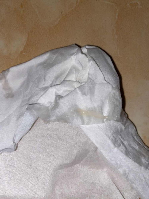 Usia kehamilan 34minggu