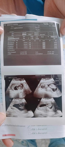 ช่วยดูหน่อยค่ะ ตอนนี้ 14+1 week