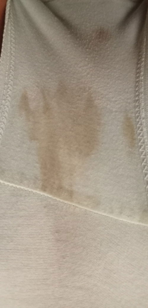 Brown Discharge or Spotting ?