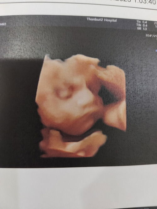 แม่ผ่าคลอกกันตอนกี่weekคะ