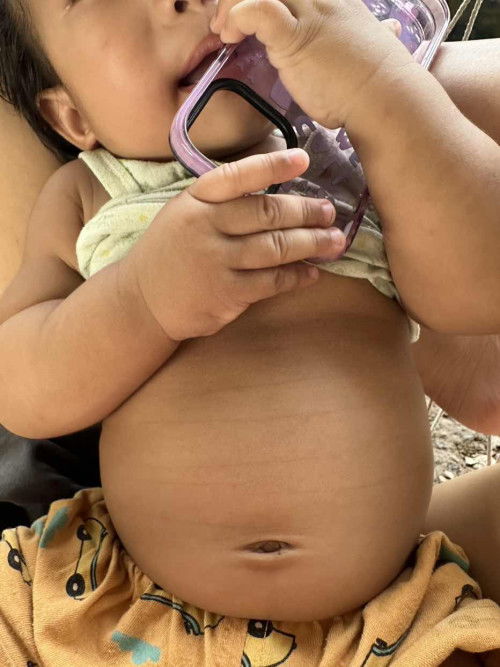 แบบนี้คืออกบุ๋มรึป่าวคะ