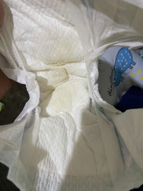 Warna pipis bayi 12 hari