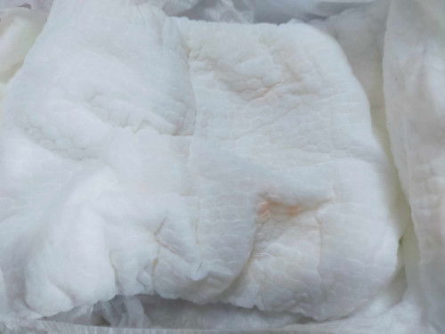 May kulay orange/red sa diaper ni baby