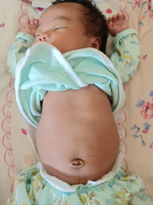 ลูกไม่เรอท้องอืดทำยังไง