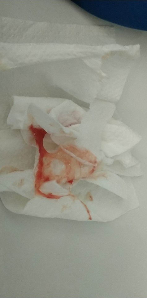 สอบถามเเม่ๆหน่อยค่ะท้องคนเเรกไม่มีประสบการณ์