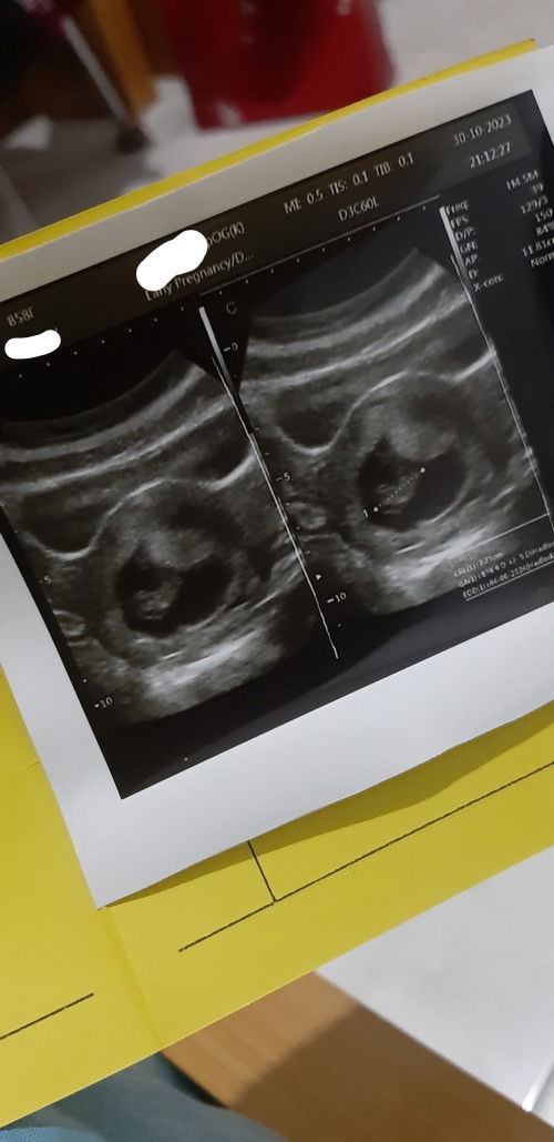 DJJ belum kedengaran