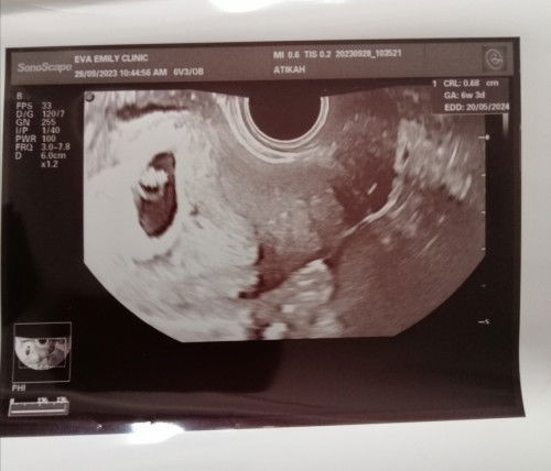 KANTUNG KOSONG KALI KEDUA