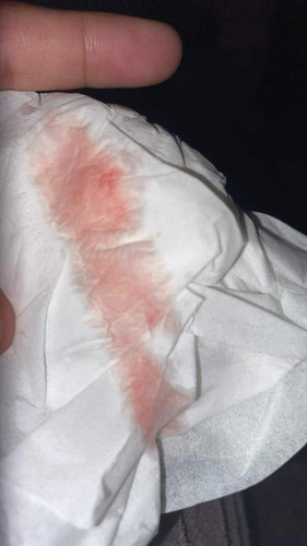 ควรไปโรงบาลไหมคะ