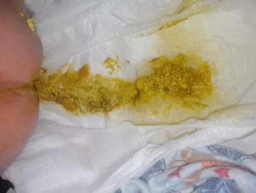 Normal lang po ba ung poop na ganto ni baby