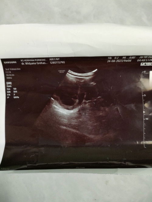 USG 9 week belum terlihat