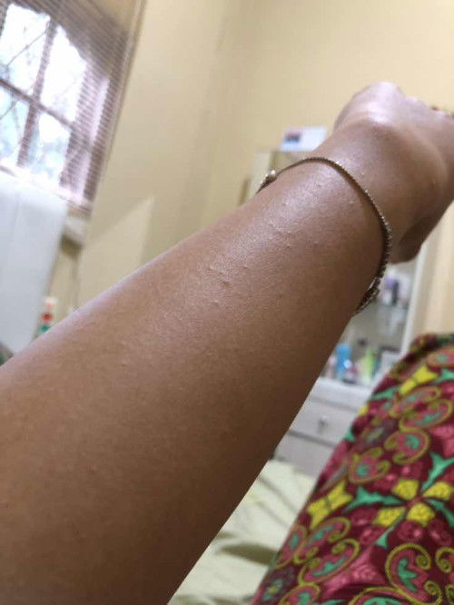 Bintik bintik di hamil 16 minggu