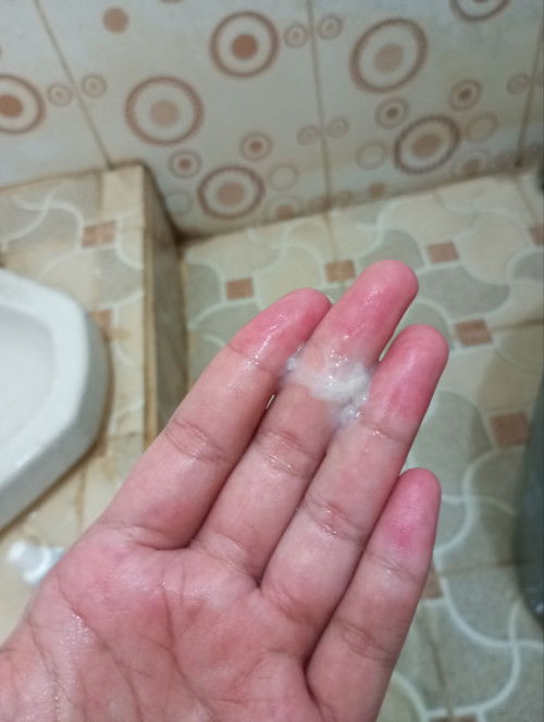 Maaf kalau foto nya menjijikan