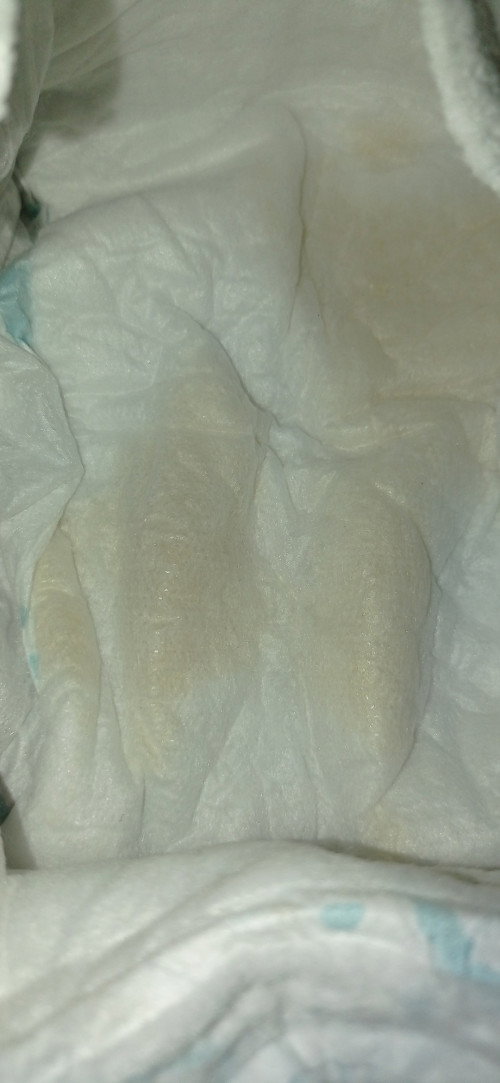 Pipis bayi