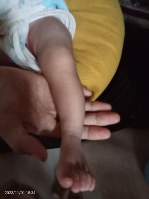 Kaki nya agak bengkok ke dalam