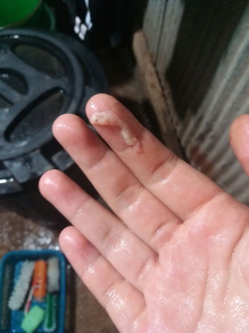 34+2อันตรายมั้ย?