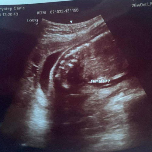 ช่วยดูให้หน่อยค่ะเพศอะไร