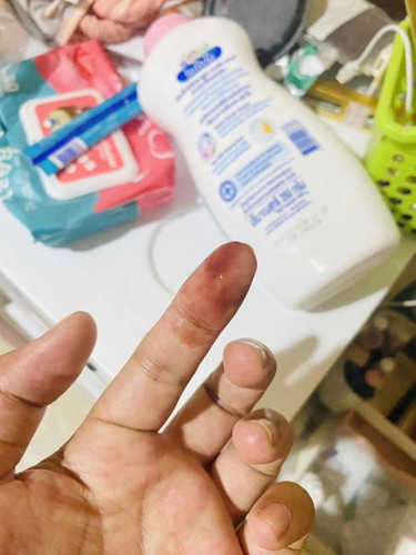 มีมูกแบบนี้ออก ตอนค่ำ