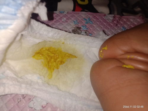 กินนมผงแบบนี่ปกติมั่ยคะ