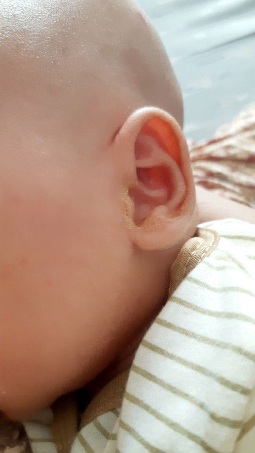 Cairan kuning telinga