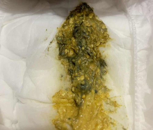 Pup anak ku berubah tekstur