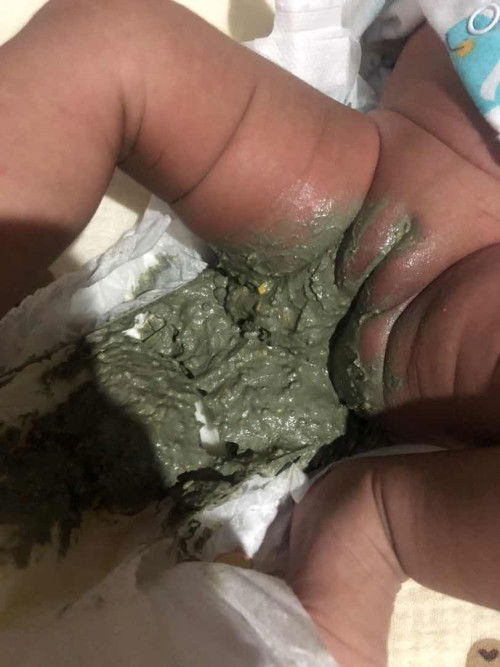 อึทารกปกติมั้ยคะ