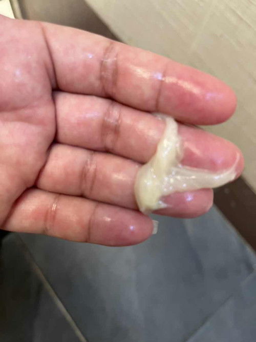 37สัปดาห์5วัน