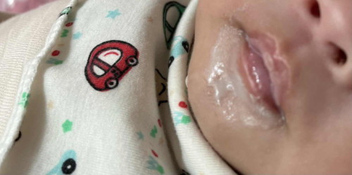 Baby always spilling milk all over chin