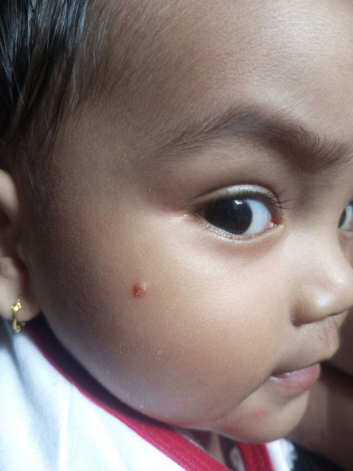 Bantu jawab bun, mungkin da kasus yang sama