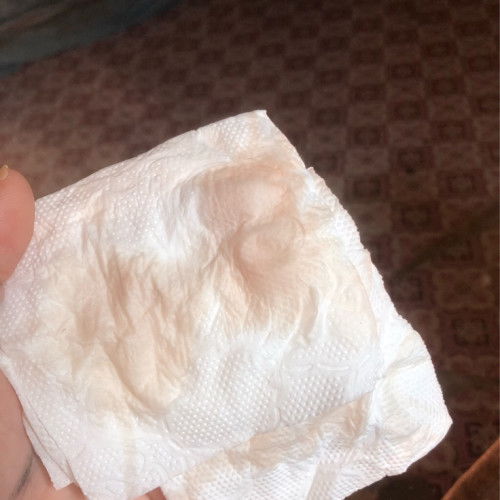 38+2 มีมูกแบบนี้ออกมา