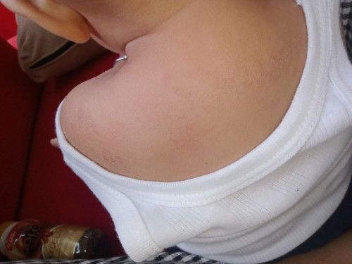 Bun dikasih apa yaa buat nyembuhinnya?