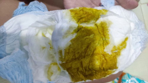 Poop baby asi 5 bulan