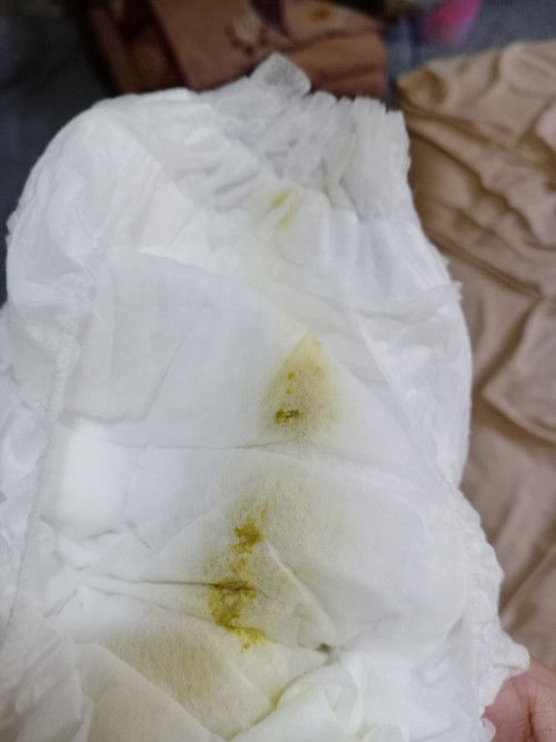 Bayi 3 bulan full asi bab hijau