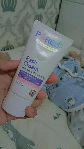Muka anak ruam