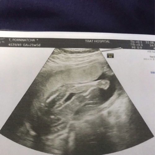 อยากสอบถามแม่ๆทุกคนคะว่า แบบนี้ผู้หญิงหรือผู้ชายคะ