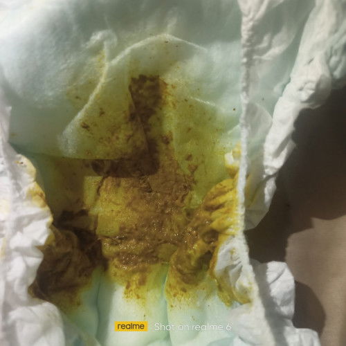 Ano po kaya Ang dahilan Ng pagtatae ng anak Kong 1 yr old and 7 months?