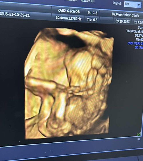 รูปนี้ตอน 17w2d มีโอกาสจะเป็นผู้หญิงหรือผู้ชายมากกว่าคะ