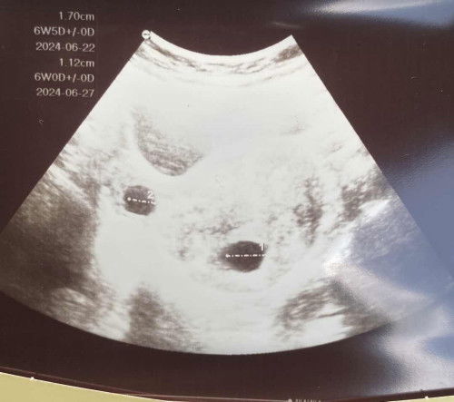 Dua kantung tapi 1 kosong