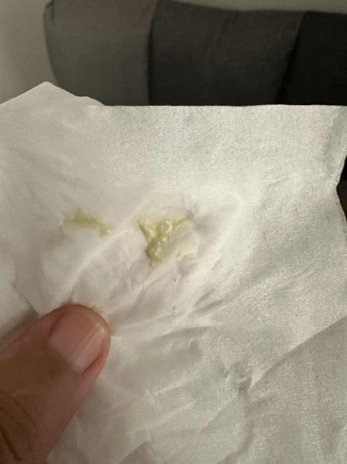 แม่ๆคนไหนเป็นตกขาวแบบนี้บางค่ะ