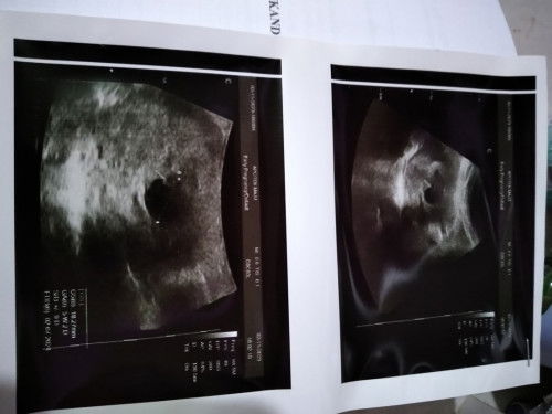 Beda hitungan di aplikasi sama di obgn